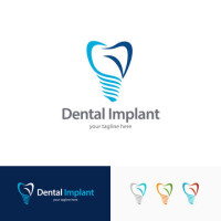 Dental implants today